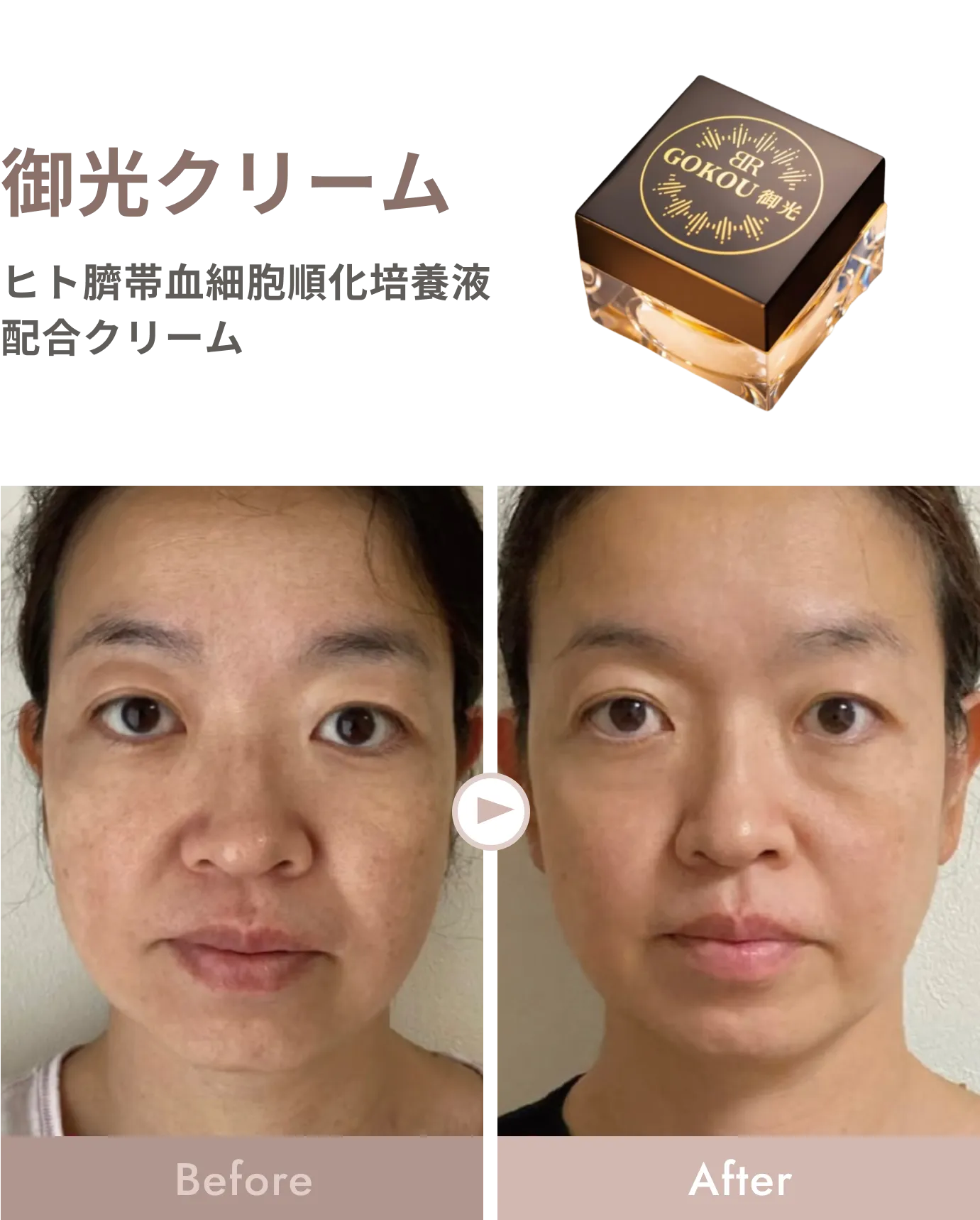 御光クリーム