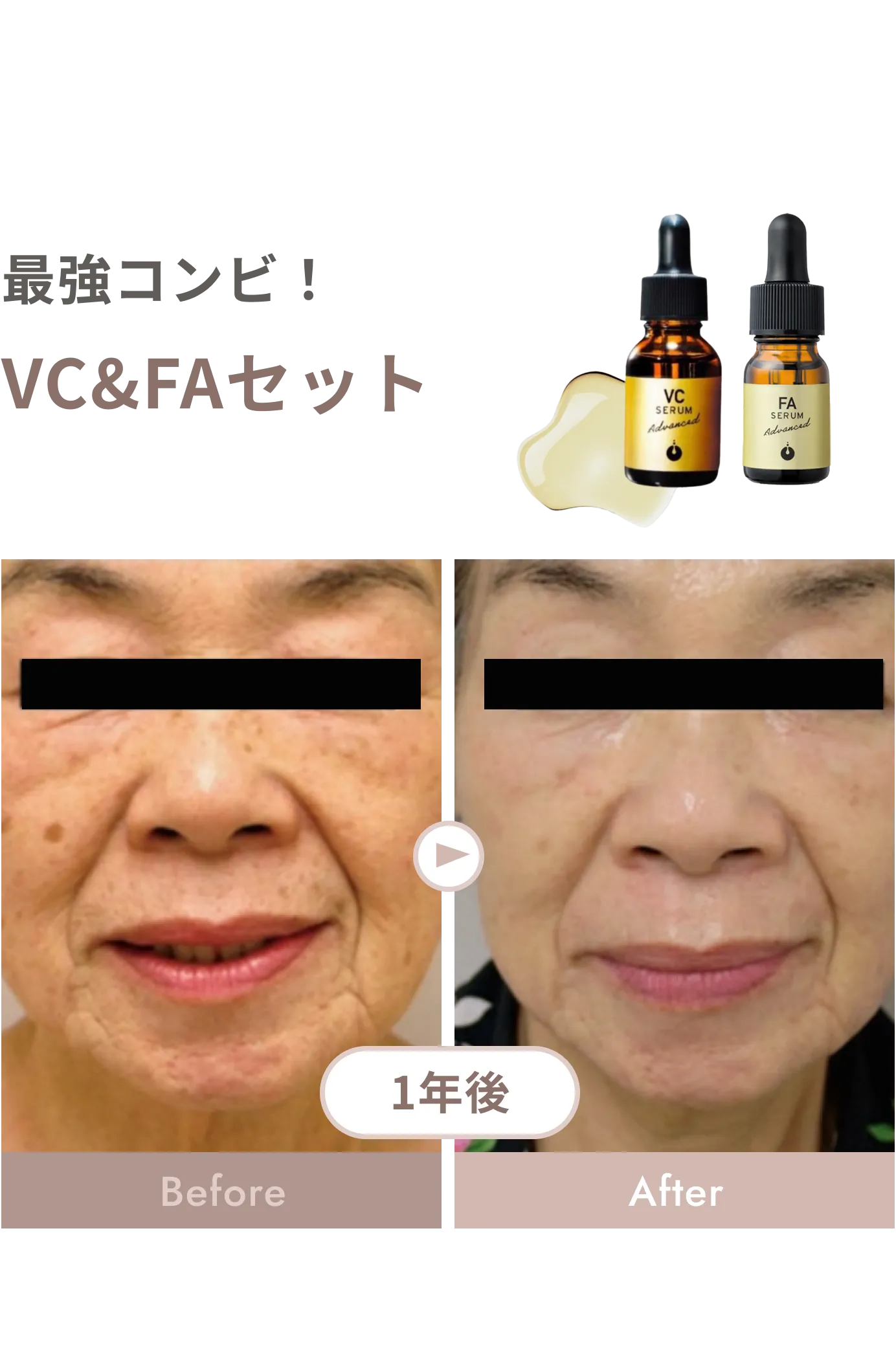 VC&FAセット